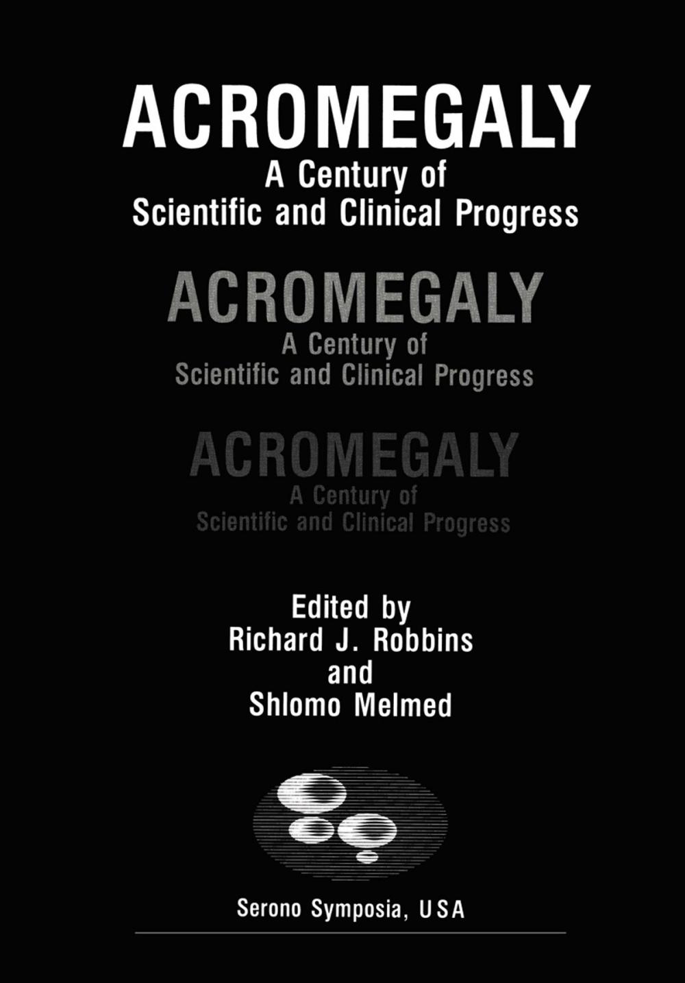 Big bigCover of Acromegaly