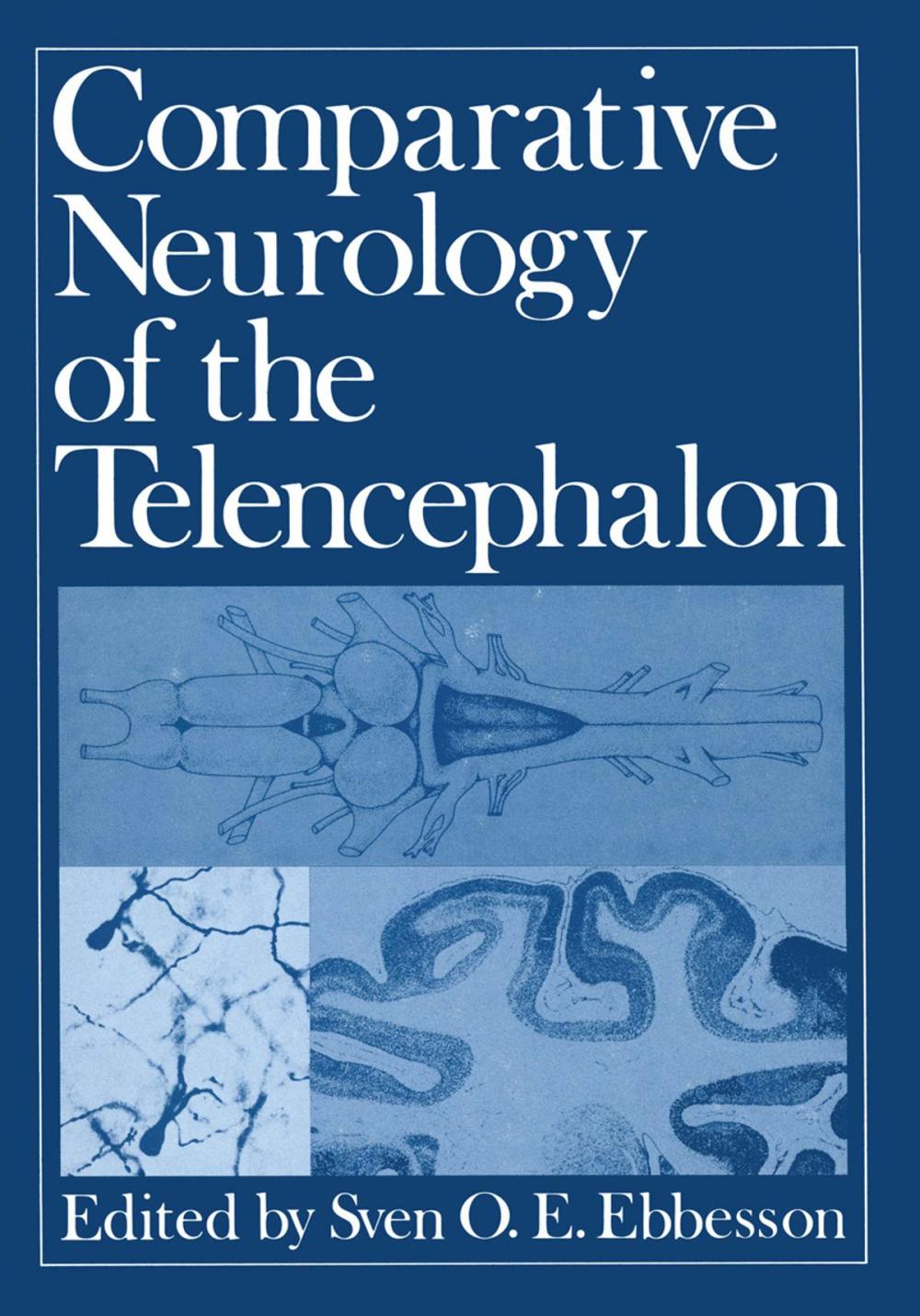 Big bigCover of Comparative Neurology of the Telencephalon