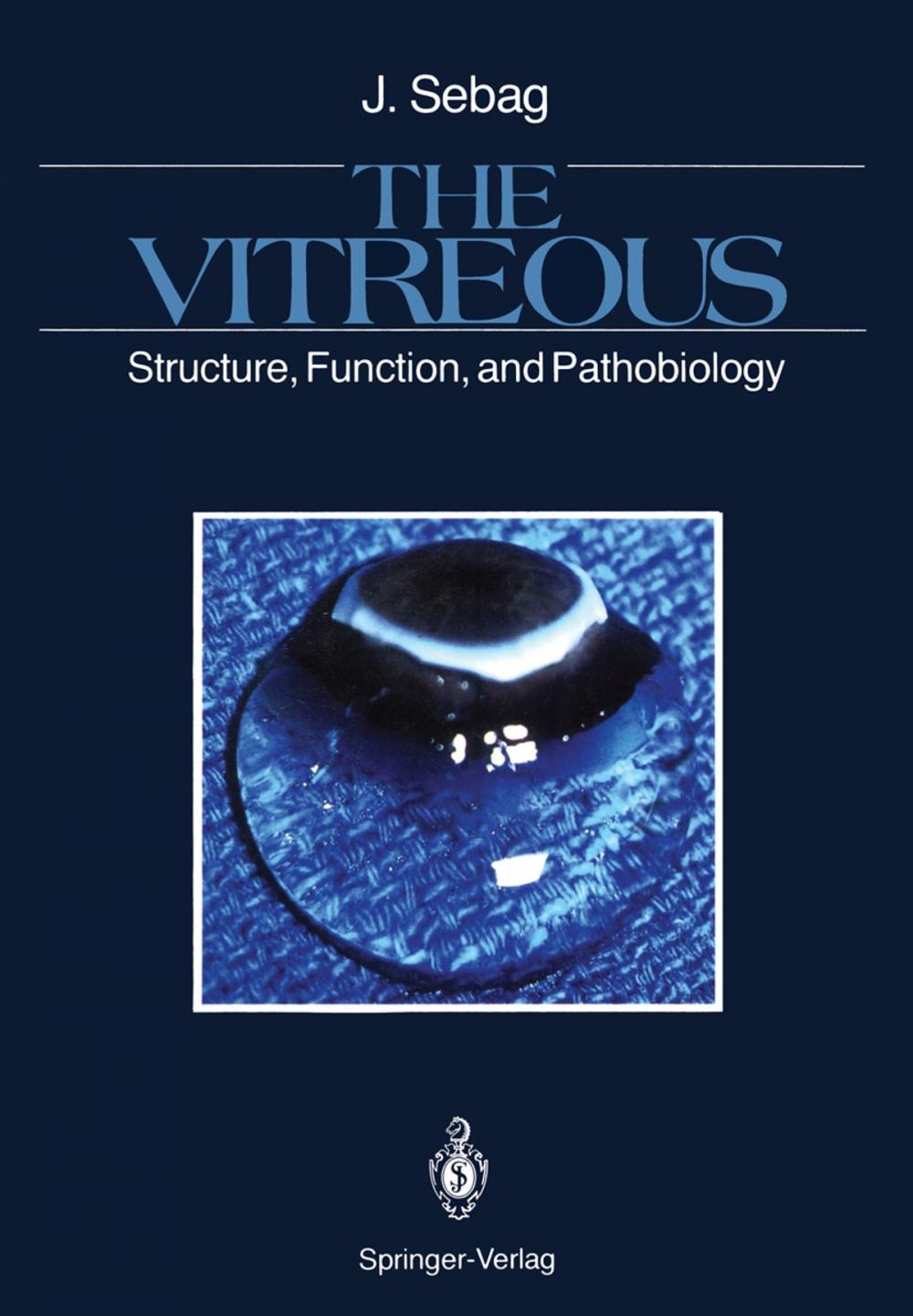 Big bigCover of The Vitreous