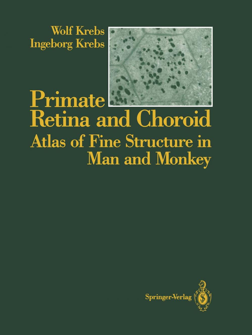 Big bigCover of Primate Retina and Choroid