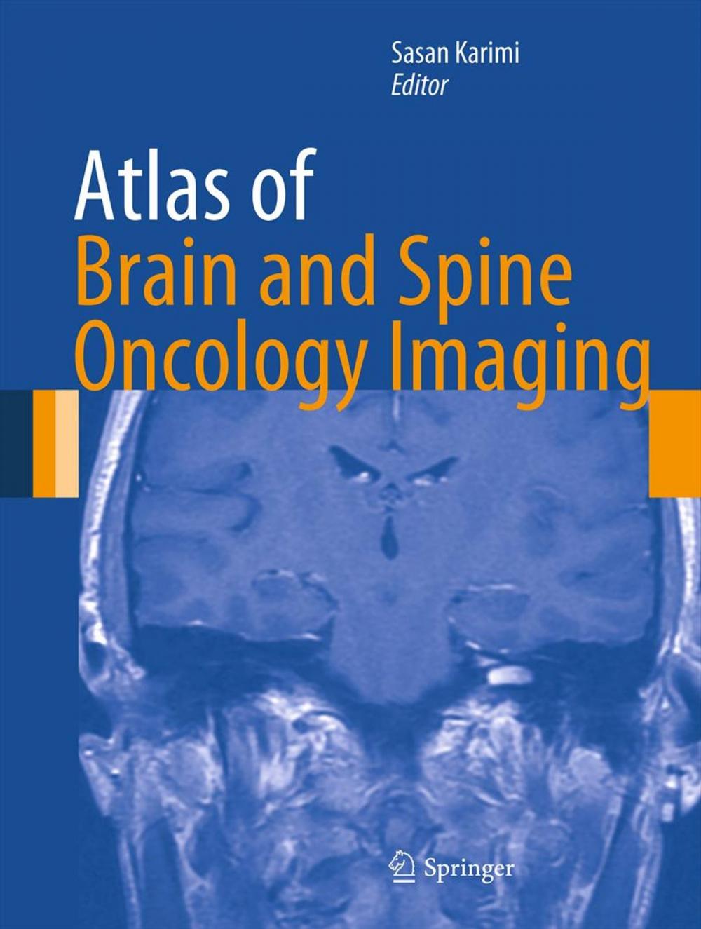 Big bigCover of Atlas of Brain and Spine Oncology Imaging