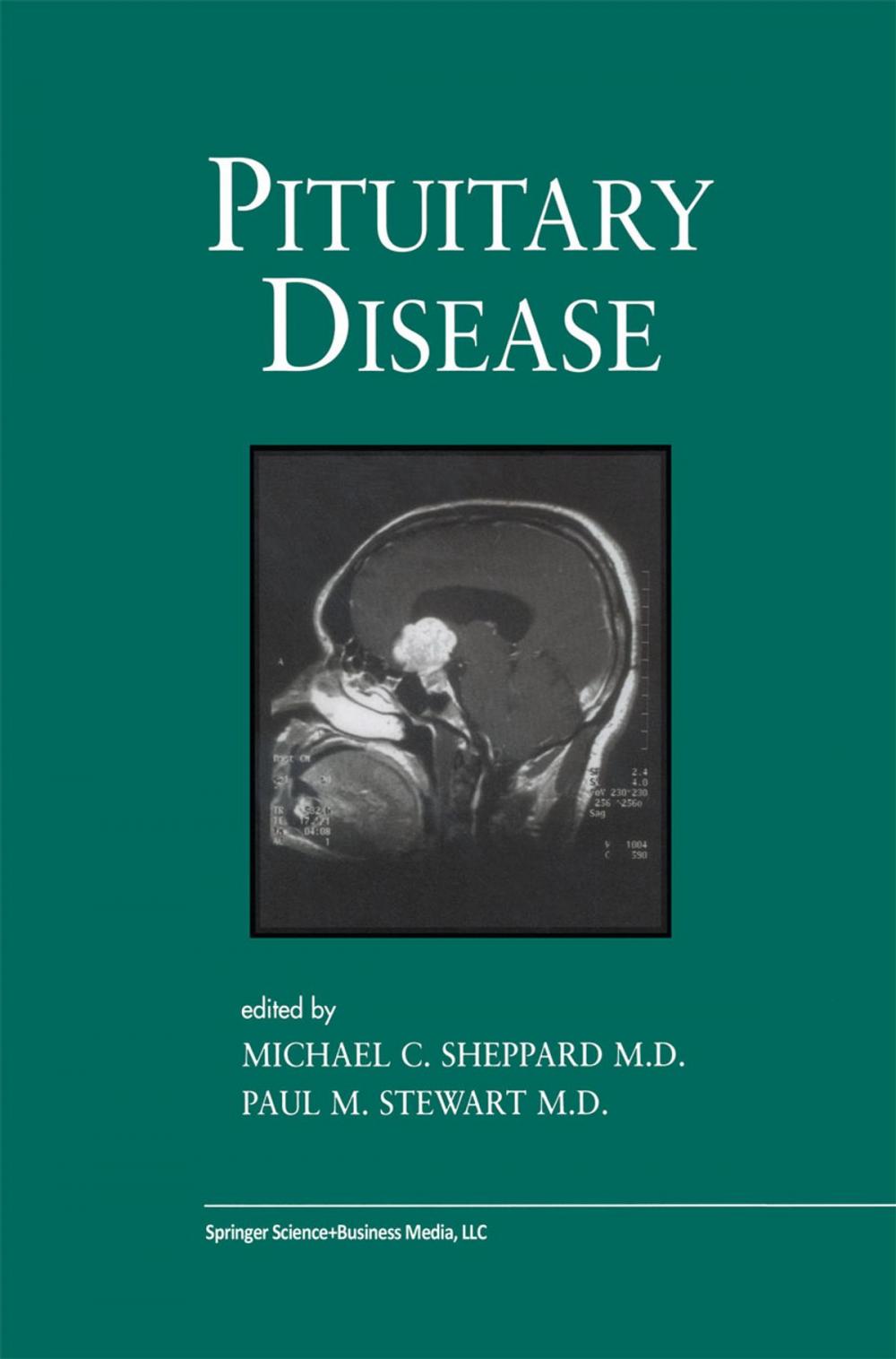 Big bigCover of Pituitary Disease