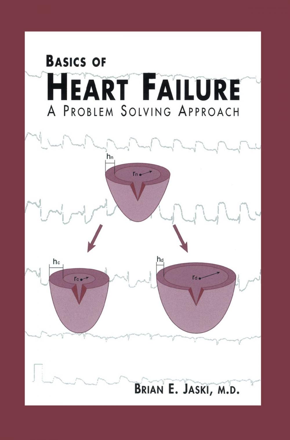 Big bigCover of Basics of Heart Failure