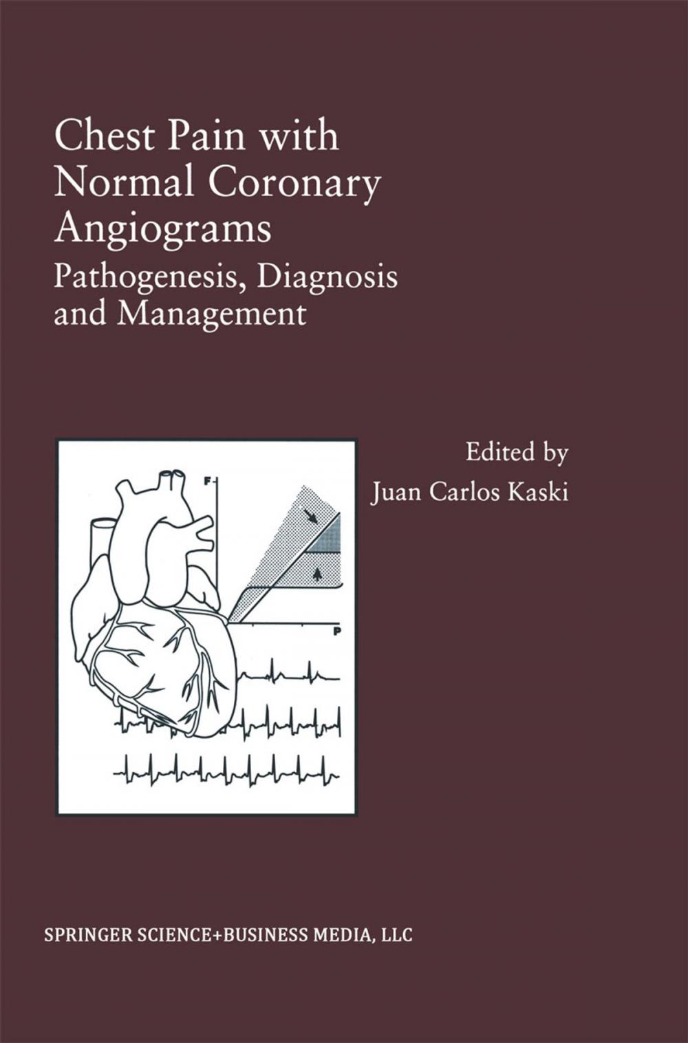 Big bigCover of Chest Pain with Normal Coronary Angiograms: Pathogenesis, Diagnosis and Management