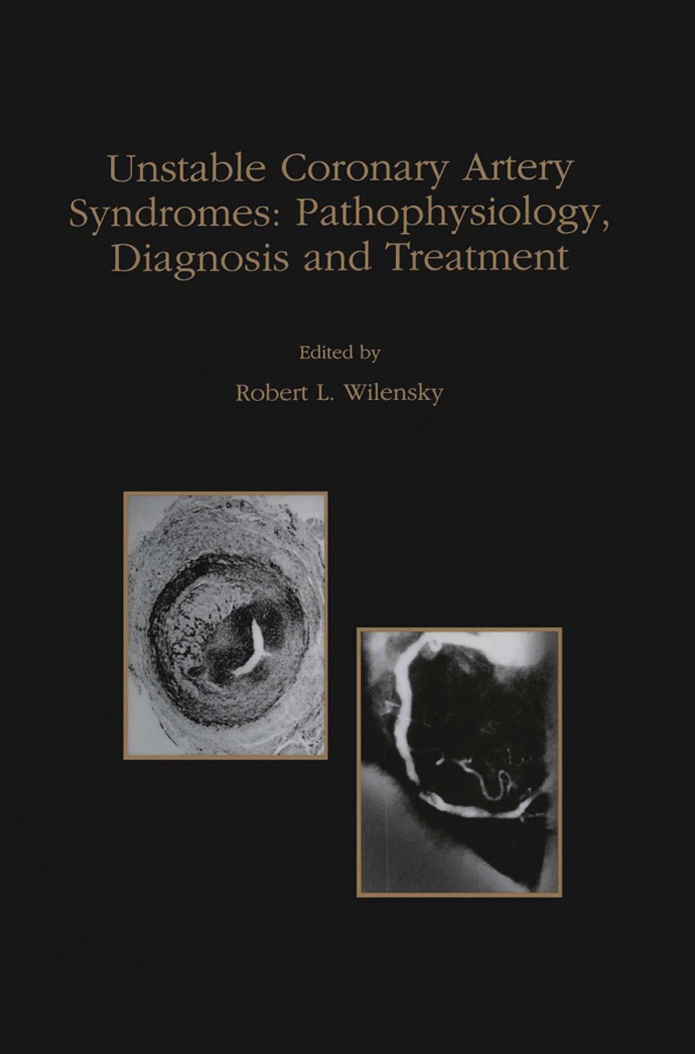 Big bigCover of Unstable Coronary Artery Syndromes Pathophysiology, Diagnosis and Treatment