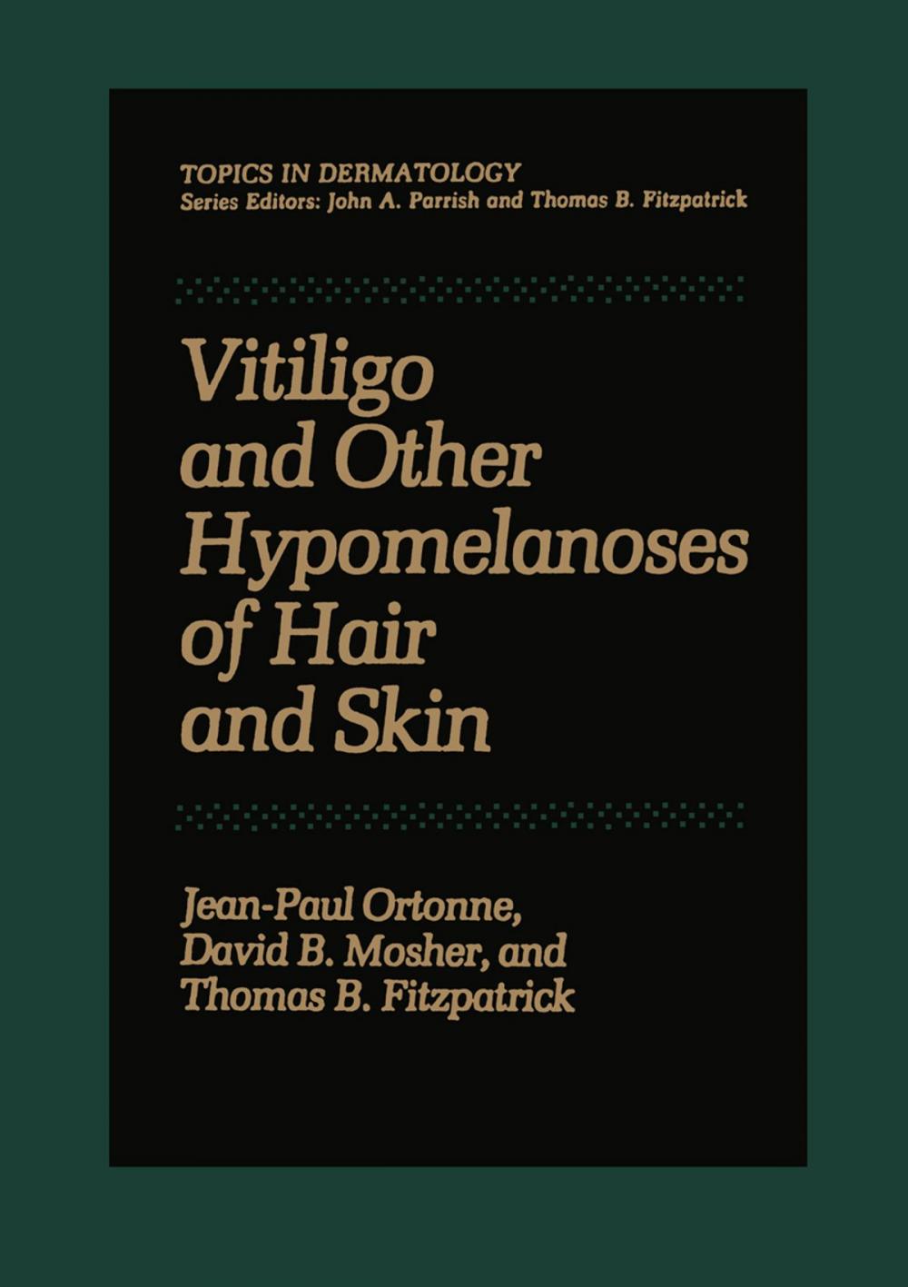 Big bigCover of Vitiligo and Other Hypomelanoses of Hair and Skin