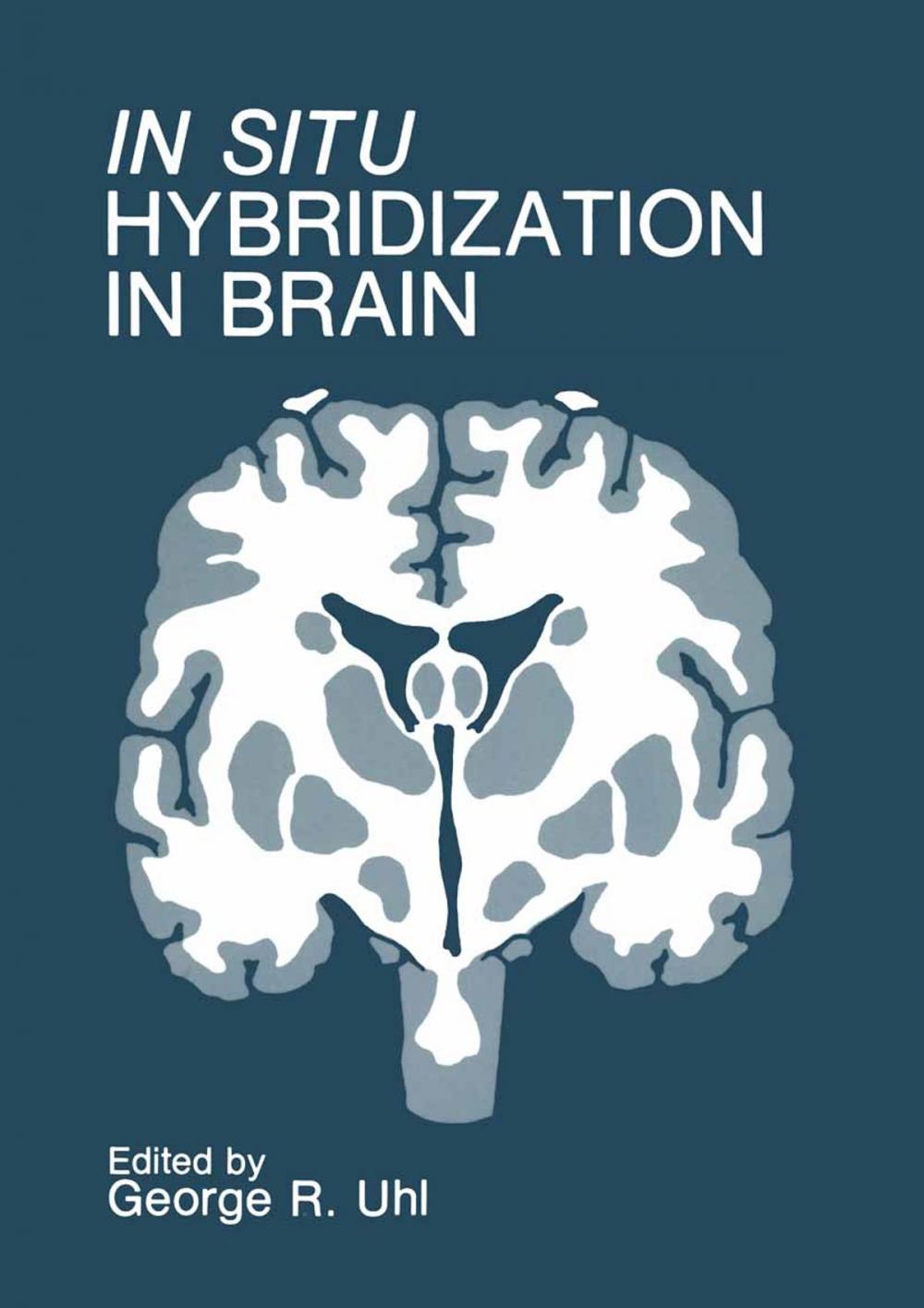 Big bigCover of In Situ Hybridization in Brain