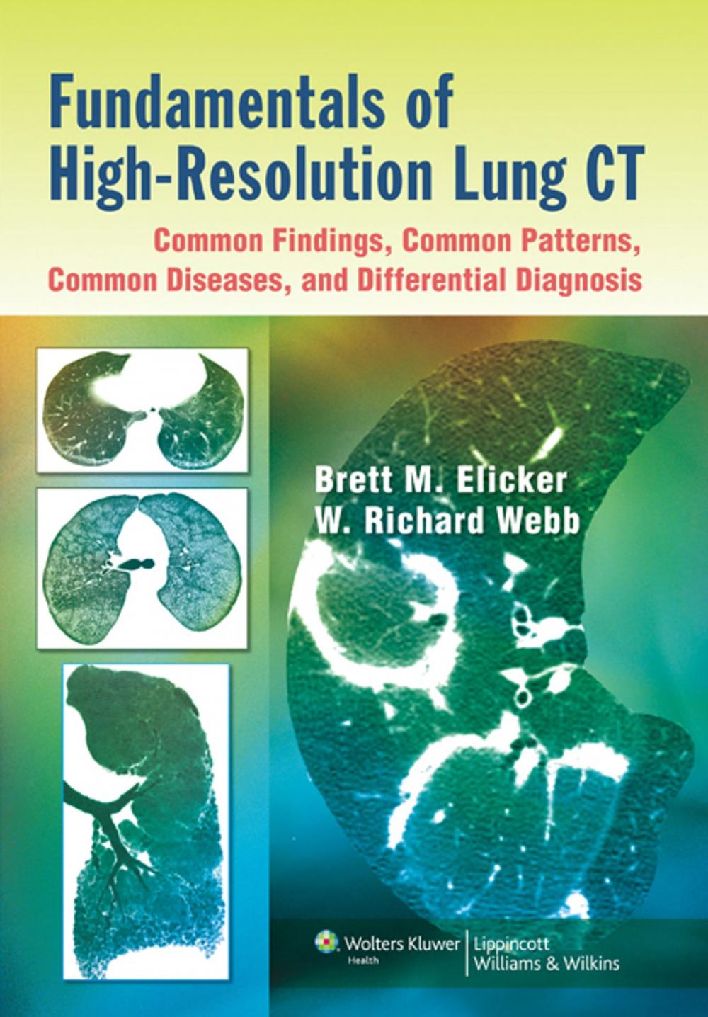 Big bigCover of Fundamentals of High-Resolution Lung CT: Common Findings, Common Patterns, Common Diseases, and Differential Diagnosis