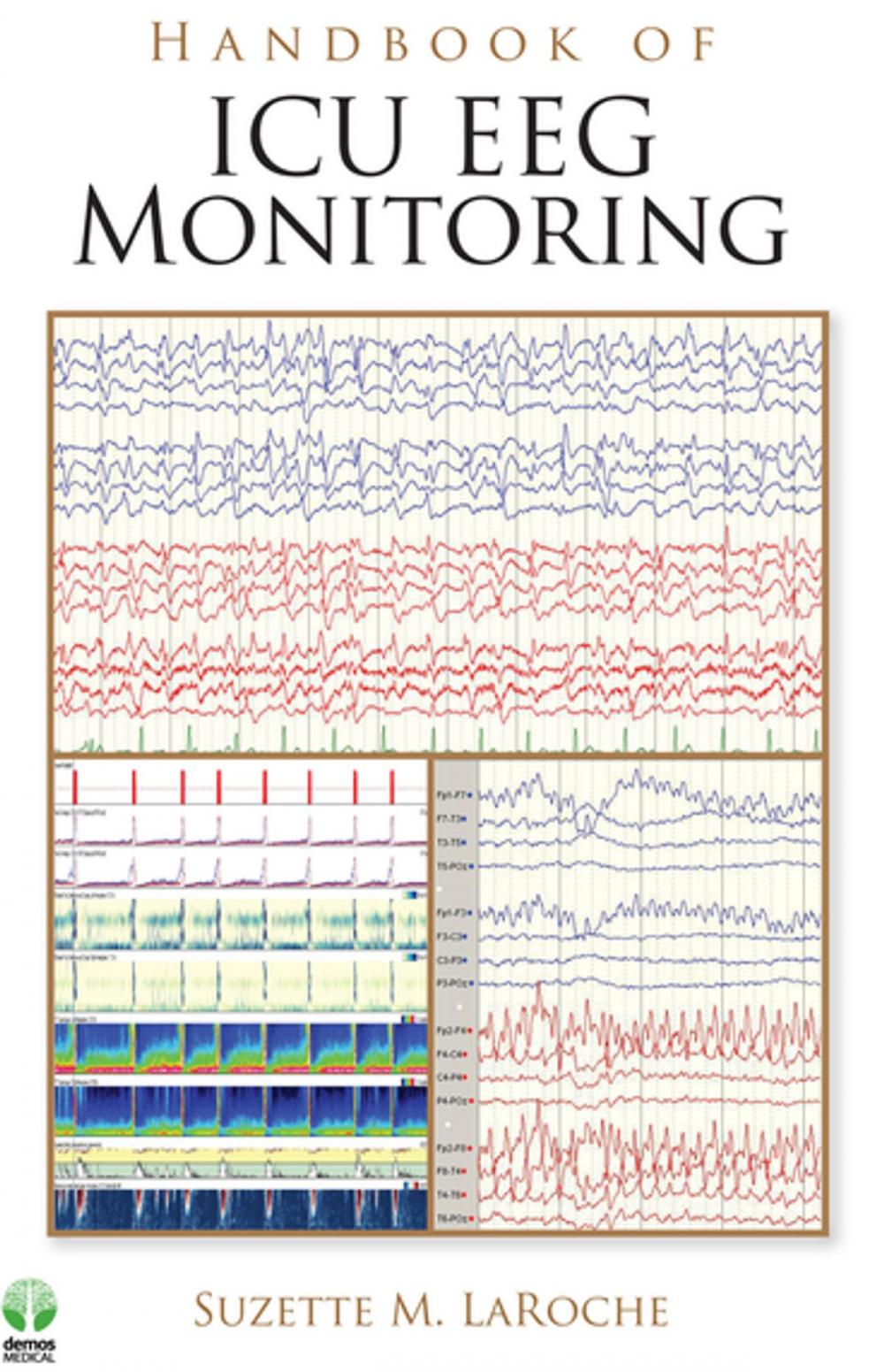 Big bigCover of Handbook of ICU EEG Monitoring