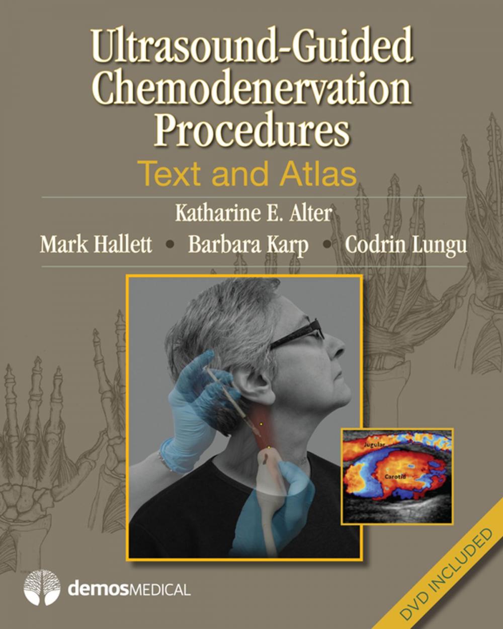 Big bigCover of Ultrasound-Guided Chemodenervation Procedures