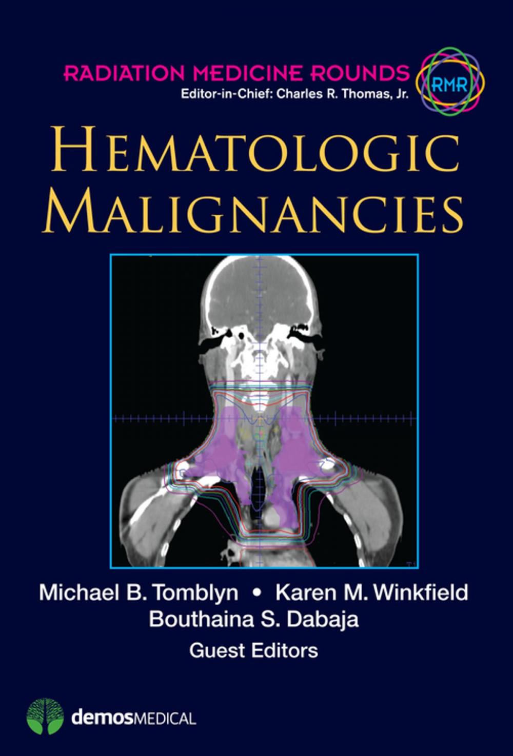 Big bigCover of Hematologic Malignancies