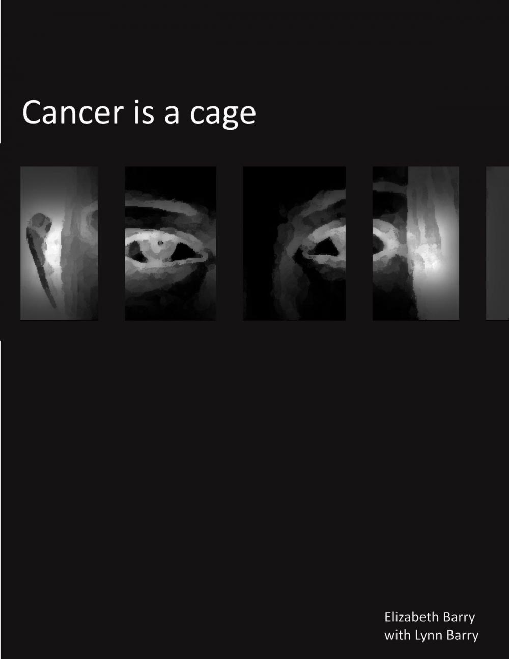 Big bigCover of Cancer Is A Cage