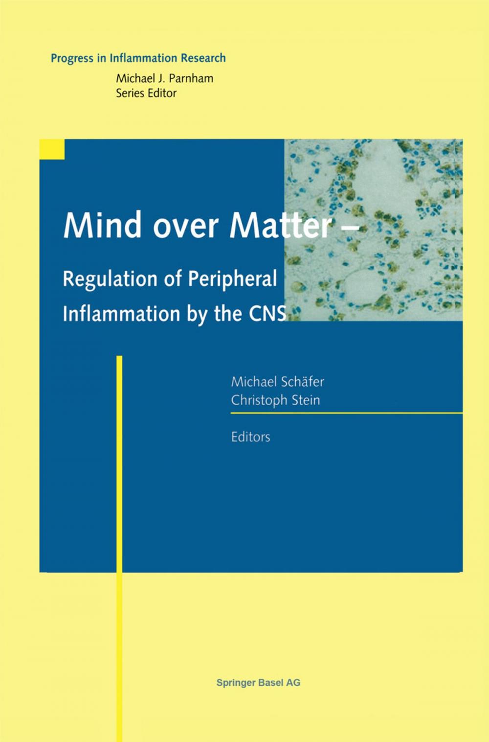 Big bigCover of Mind over Matter - Regulation of Peripheral Inflammation by the CNS