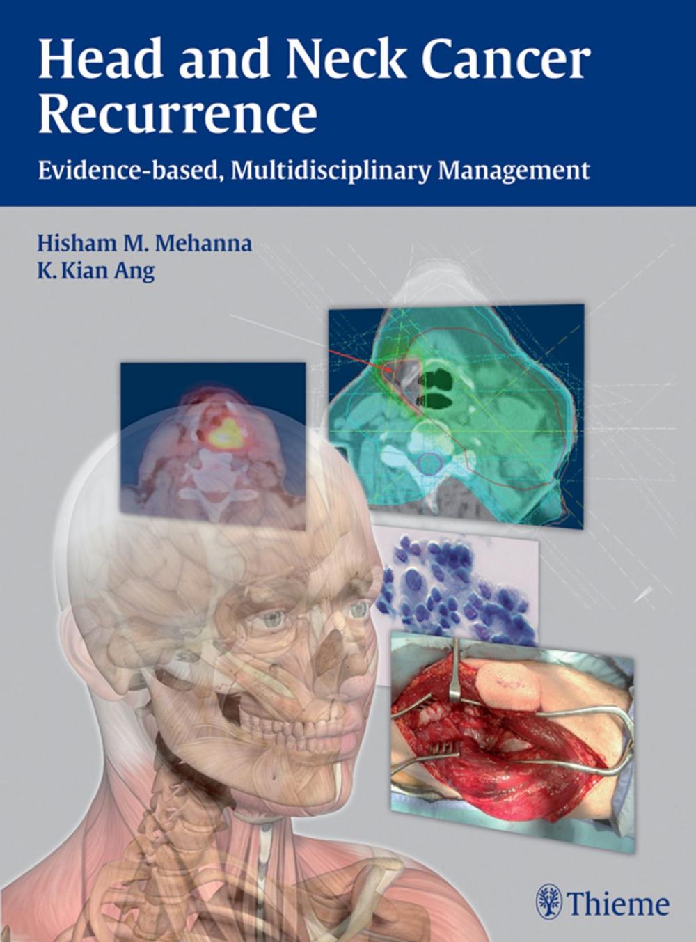 Big bigCover of Head and Neck Cancer Recurrence