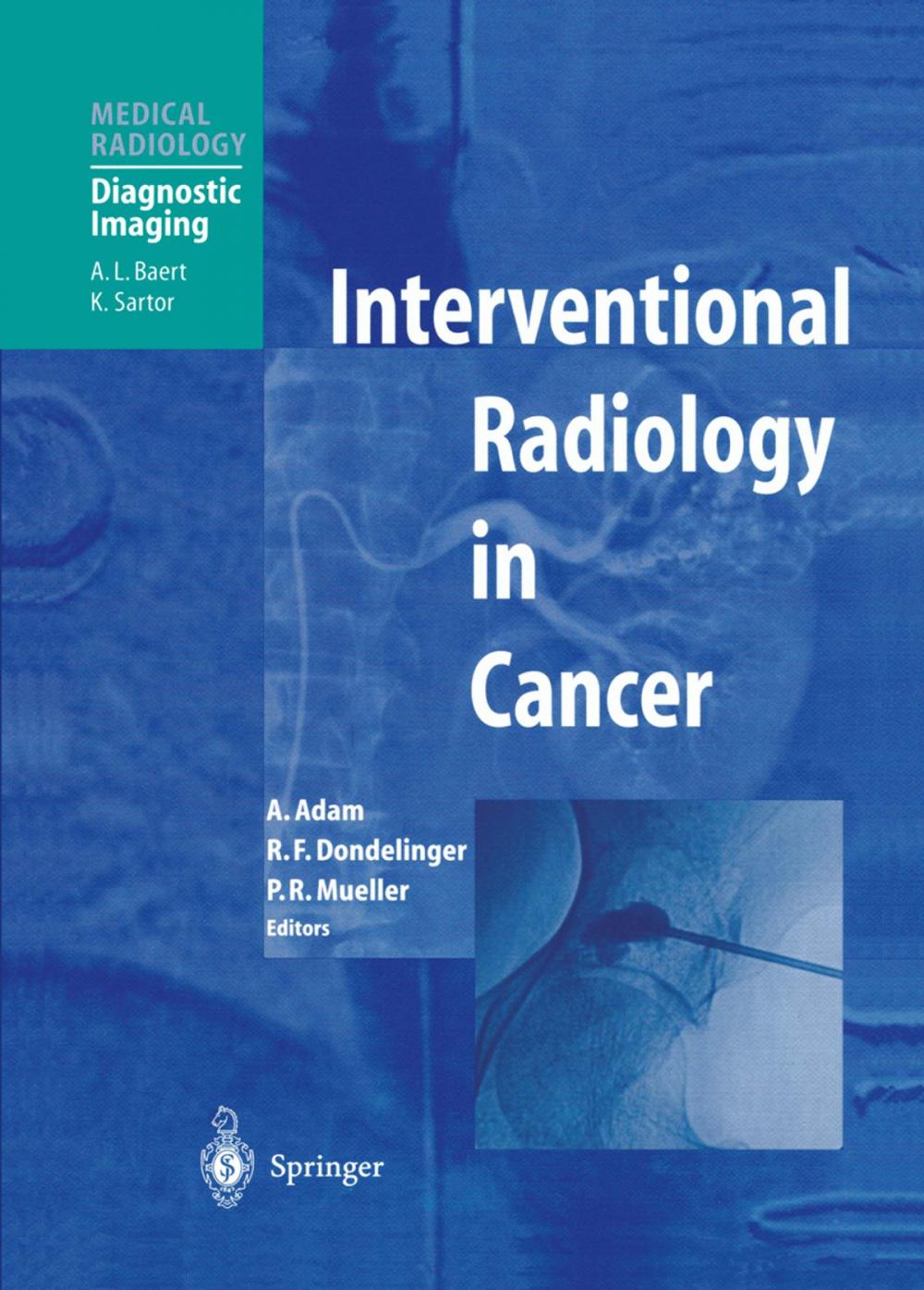 Big bigCover of Interventional Radiology in Cancer