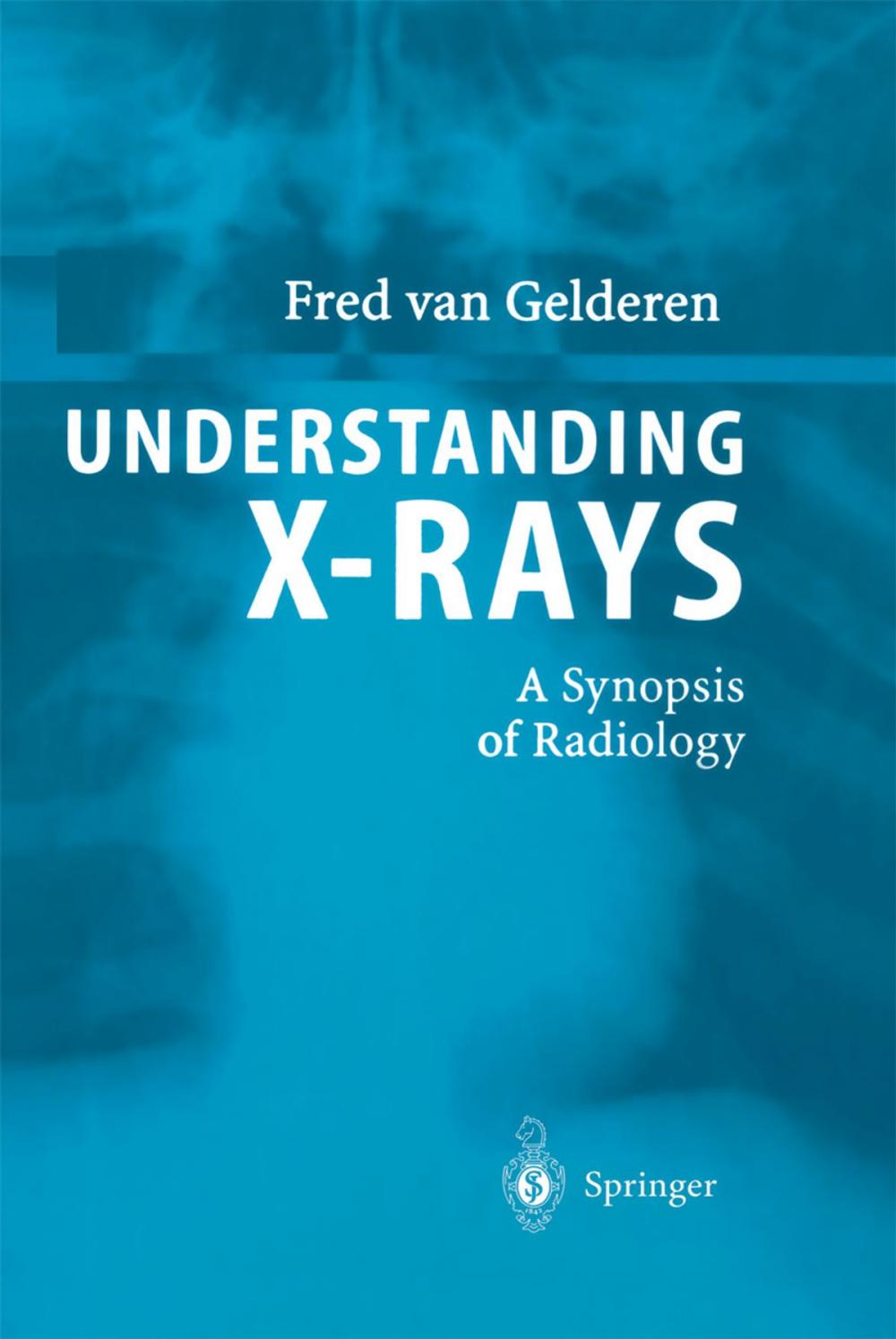 Big bigCover of Understanding X-Rays