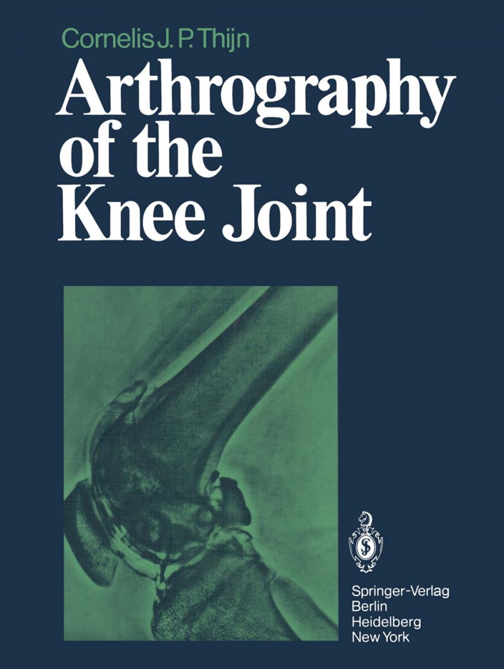 Big bigCover of Arthrography of the Knee Joint