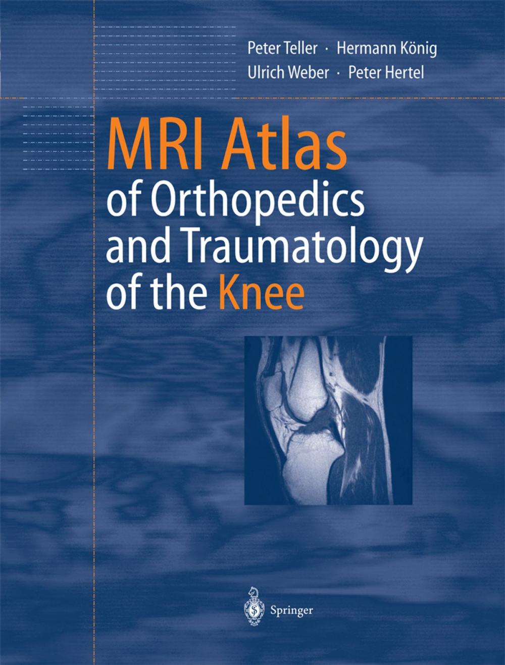 Big bigCover of MRI Atlas of Orthopedics and Traumatology of the Knee