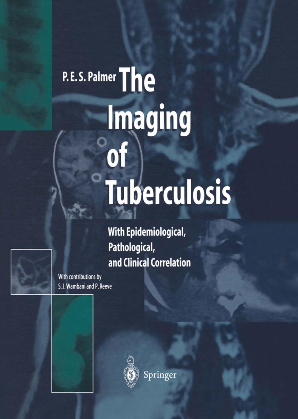 Big bigCover of The Imaging of Tuberculosis