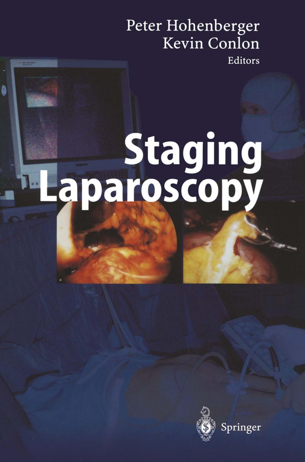 Big bigCover of Staging Laparoscopy