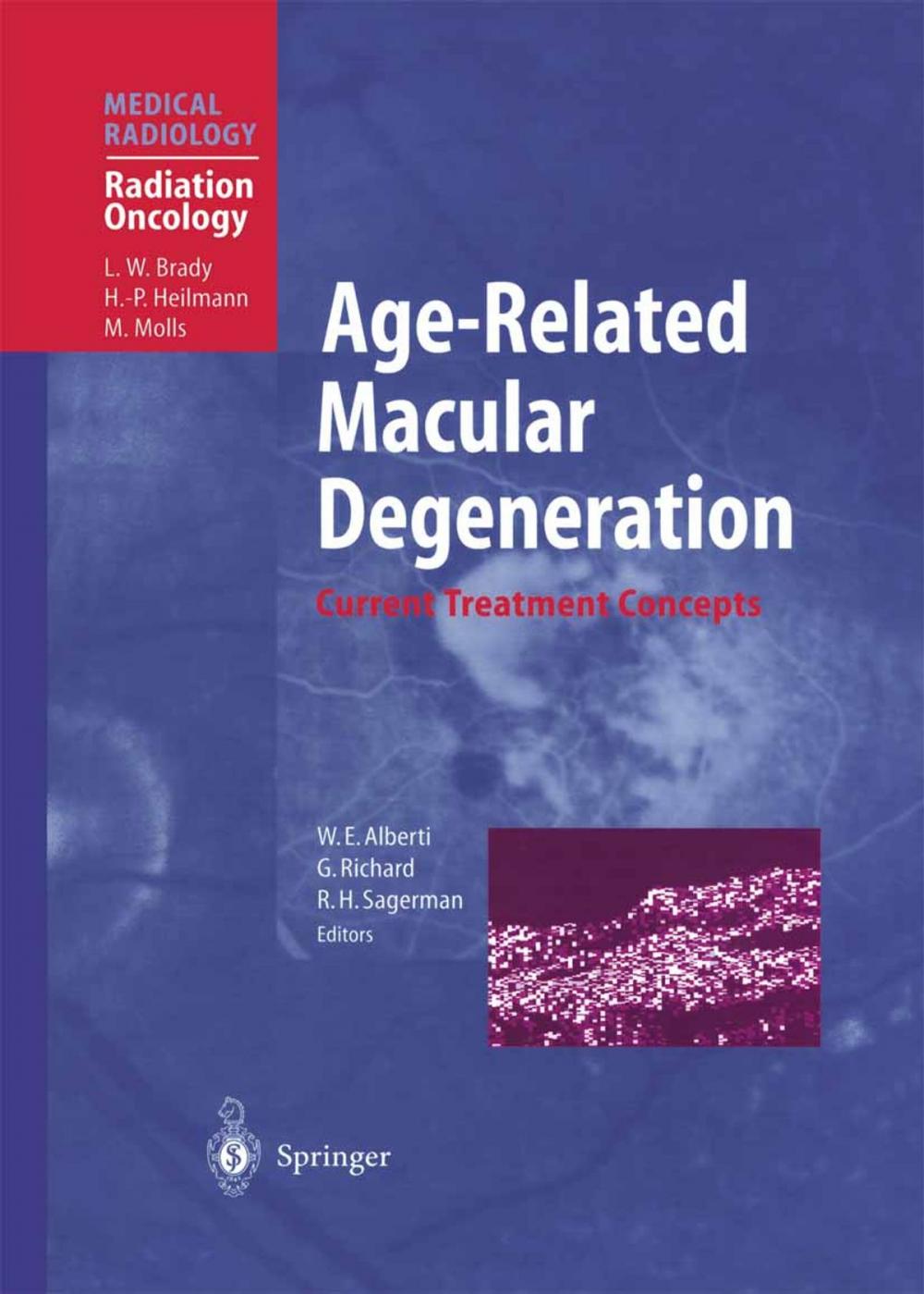 Big bigCover of Age-Related Macular Degeneration