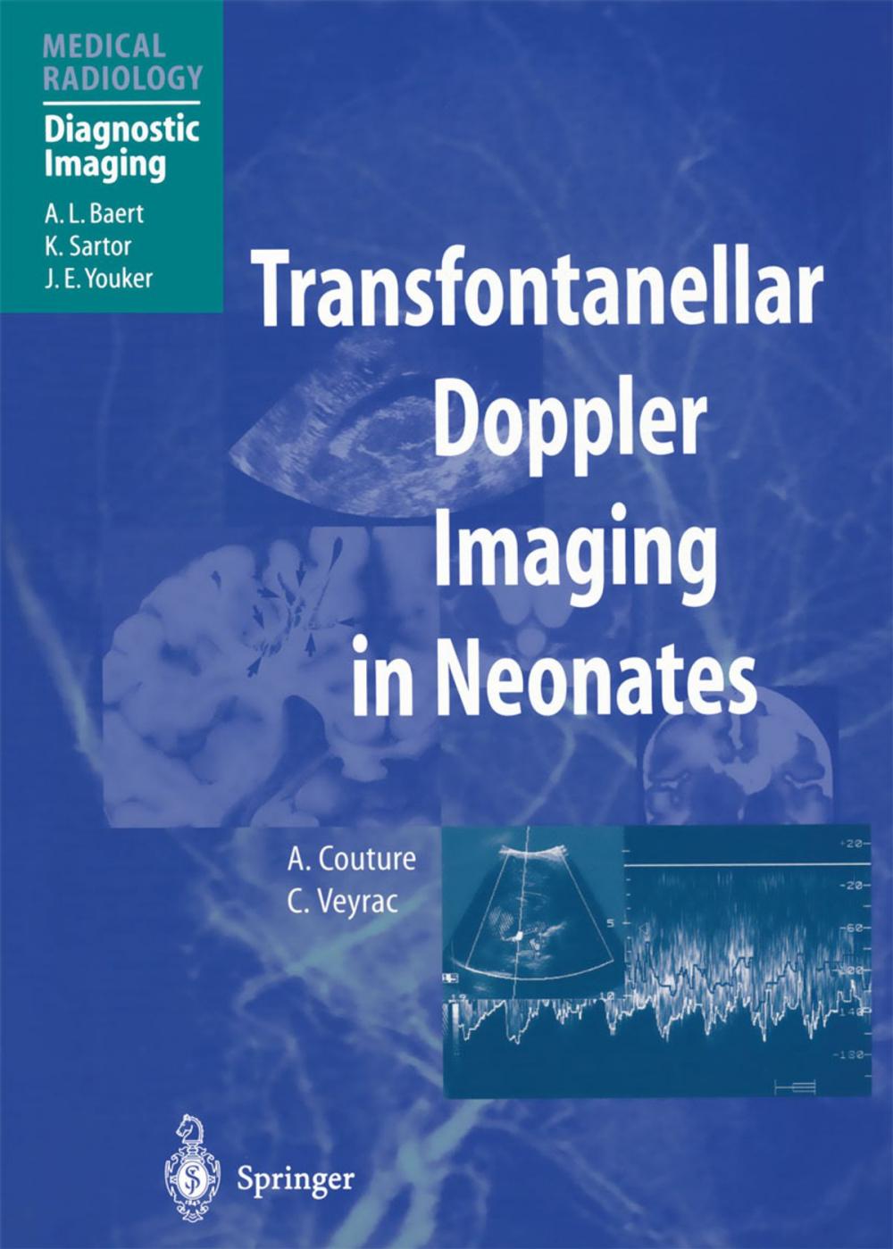 Big bigCover of Transfontanellar Doppler Imaging in Neonates