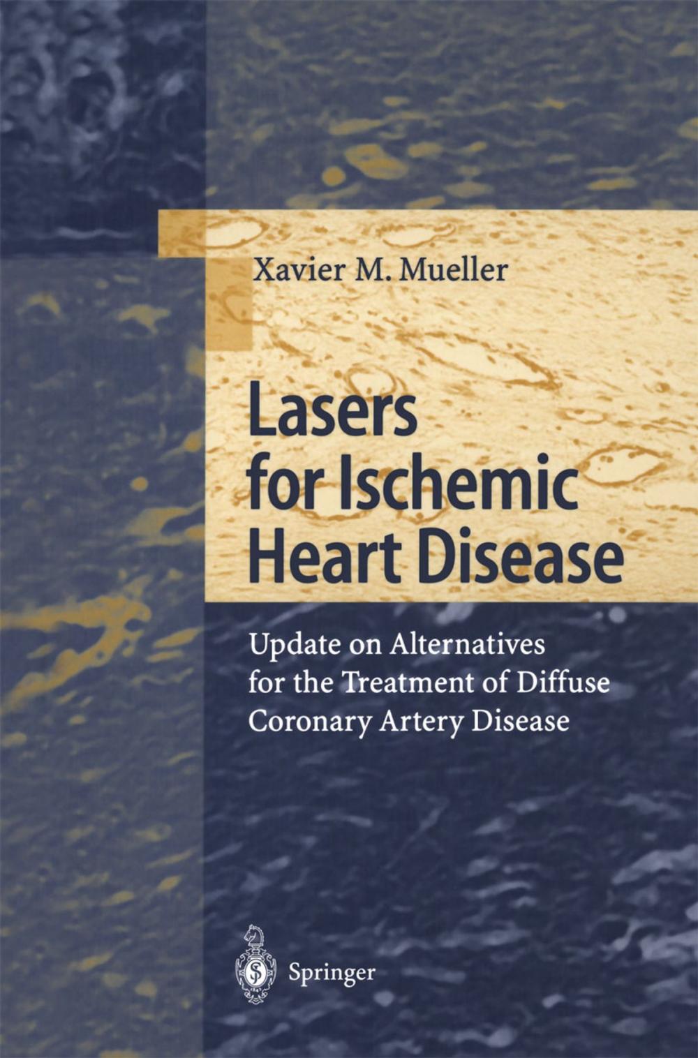 Big bigCover of Lasers for Ischemic Heart Disease