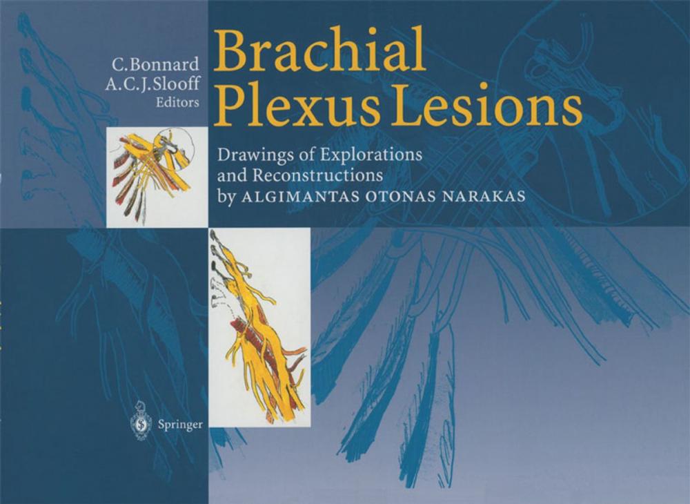 Big bigCover of Brachial Plexus Lesions