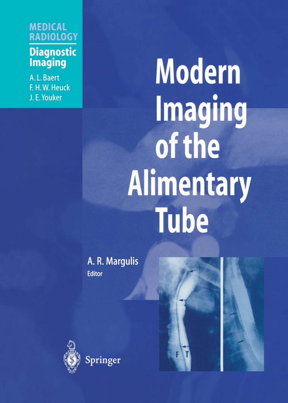 Big bigCover of Modern Imaging of the Alimentary Tube