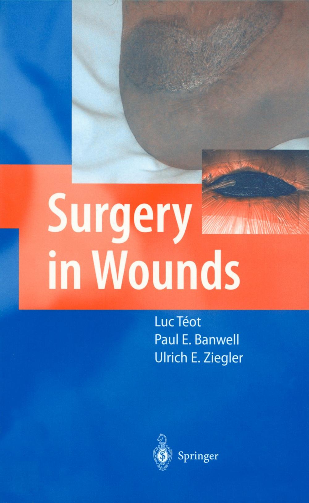 Big bigCover of Surgery in Wounds
