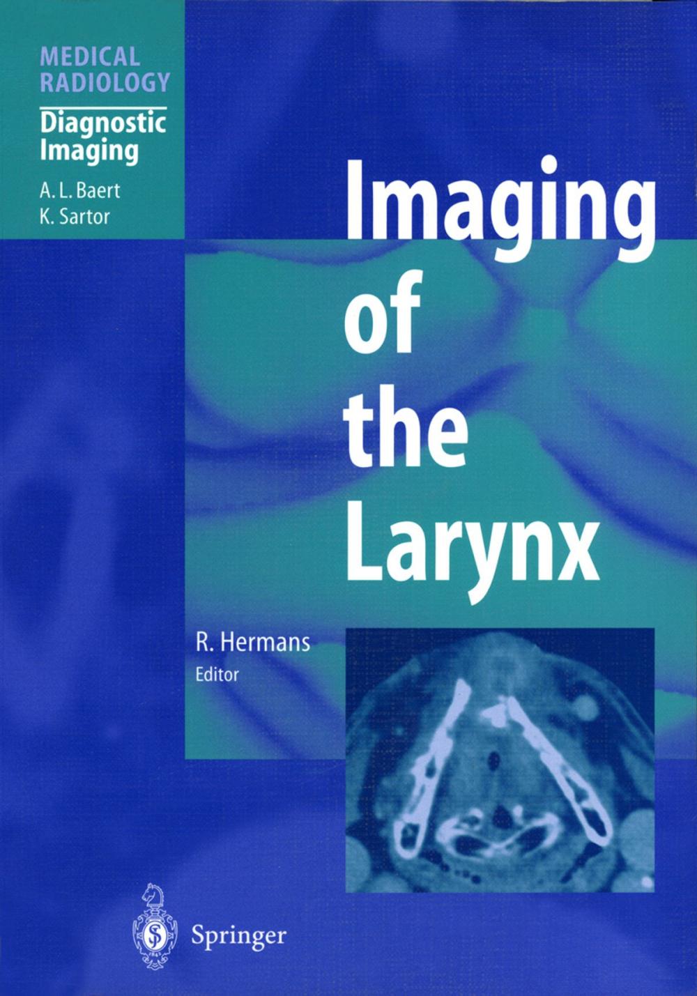 Big bigCover of Imaging of the Larynx