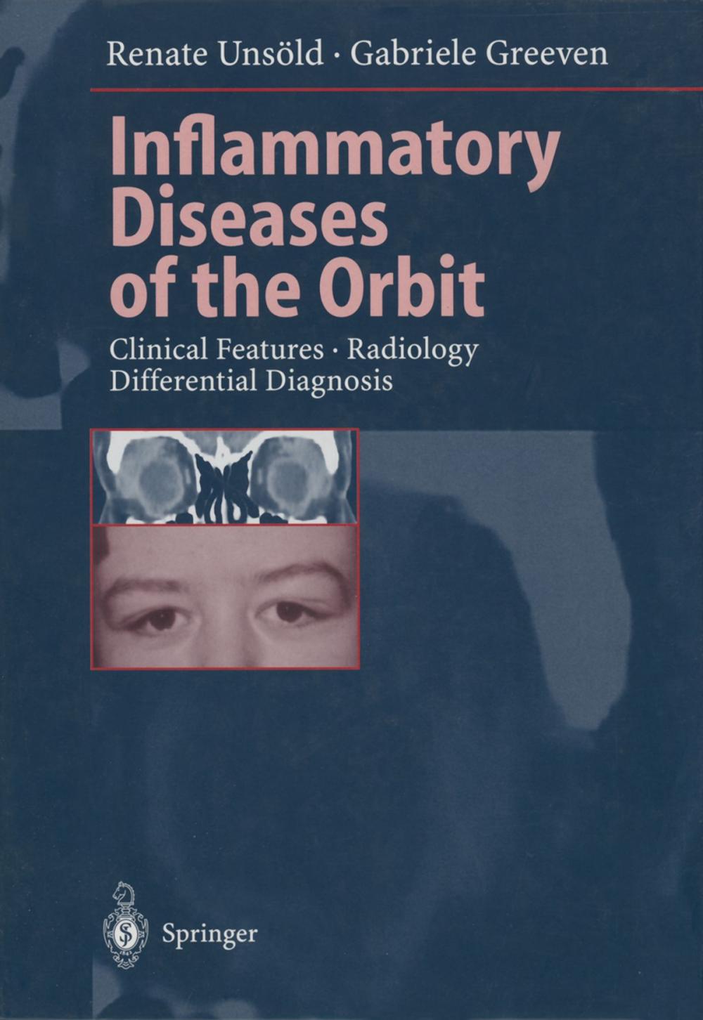 Big bigCover of Inflammatory Diseases of the Orbit