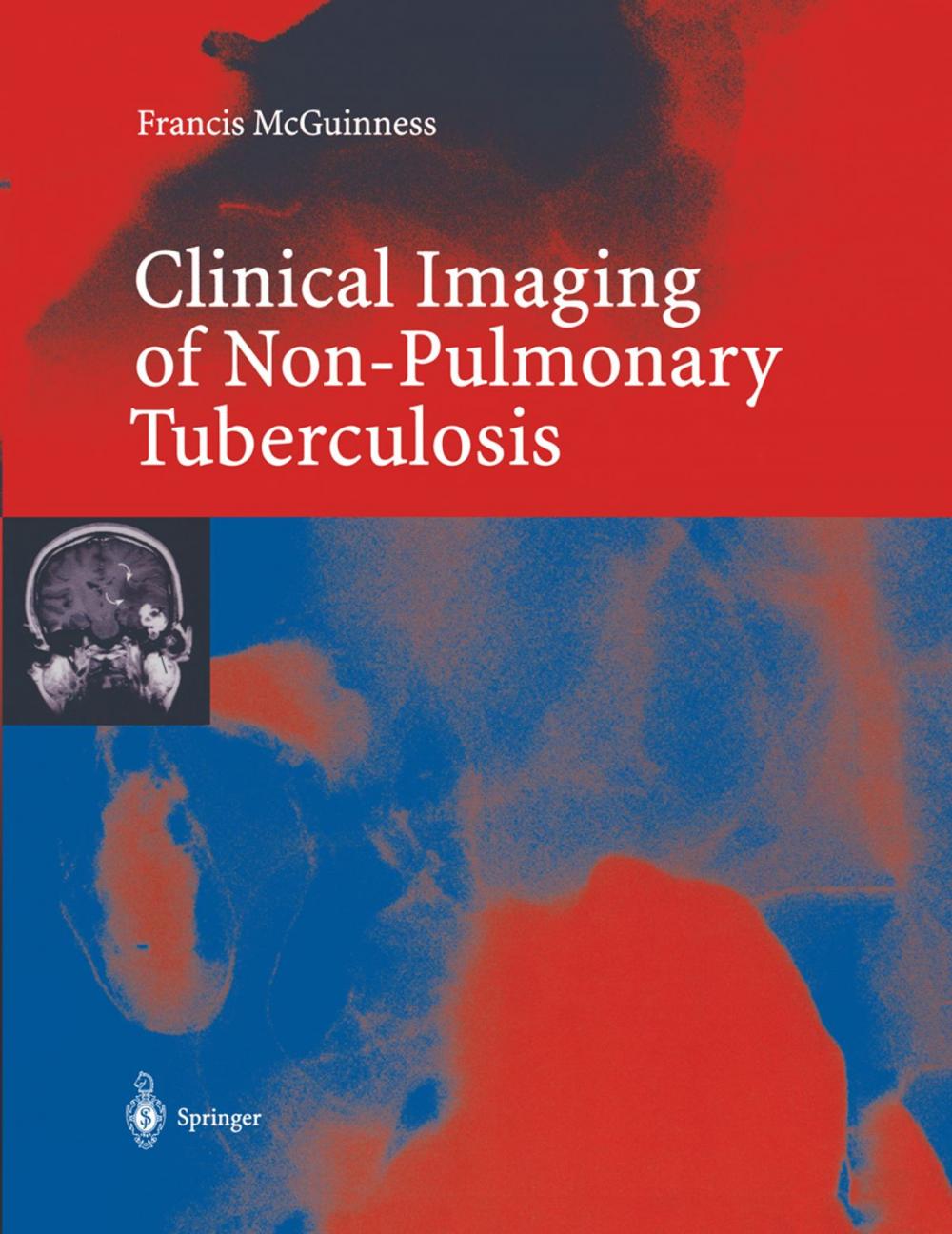 Big bigCover of Clinical Imaging in Non-Pulmonary Tuberculosis