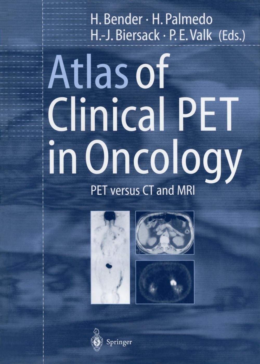 Big bigCover of Atlas of Clinical PET in Oncology