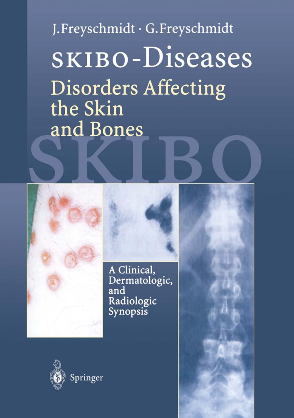 Big bigCover of SKIBO-Diseases Disorders Affecting the Skin and Bones