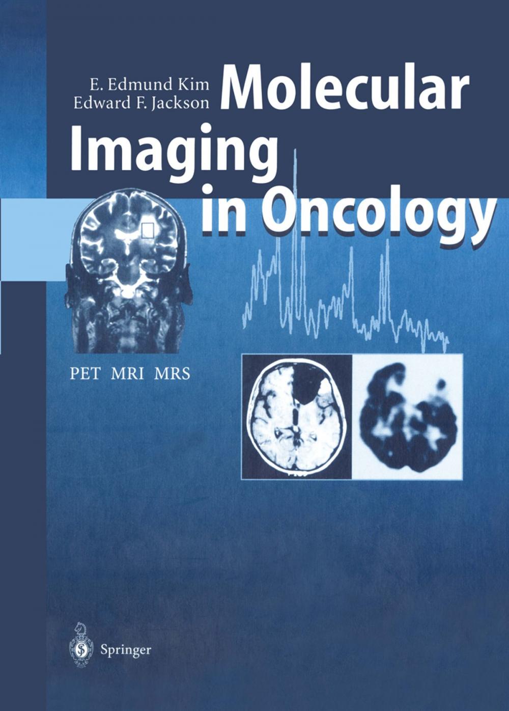 Big bigCover of Molecular Imaging in Oncology