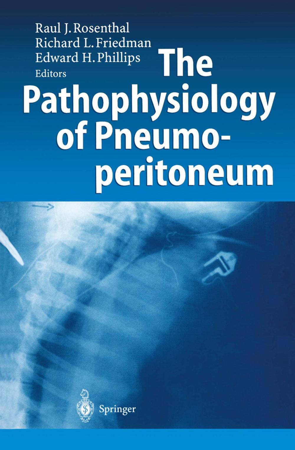 Big bigCover of The Pathophysiology of Pneumoperitoneum