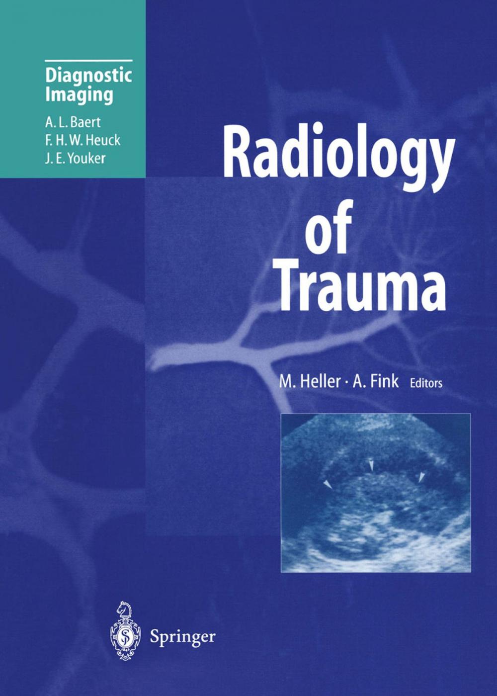 Big bigCover of Radiology of Trauma