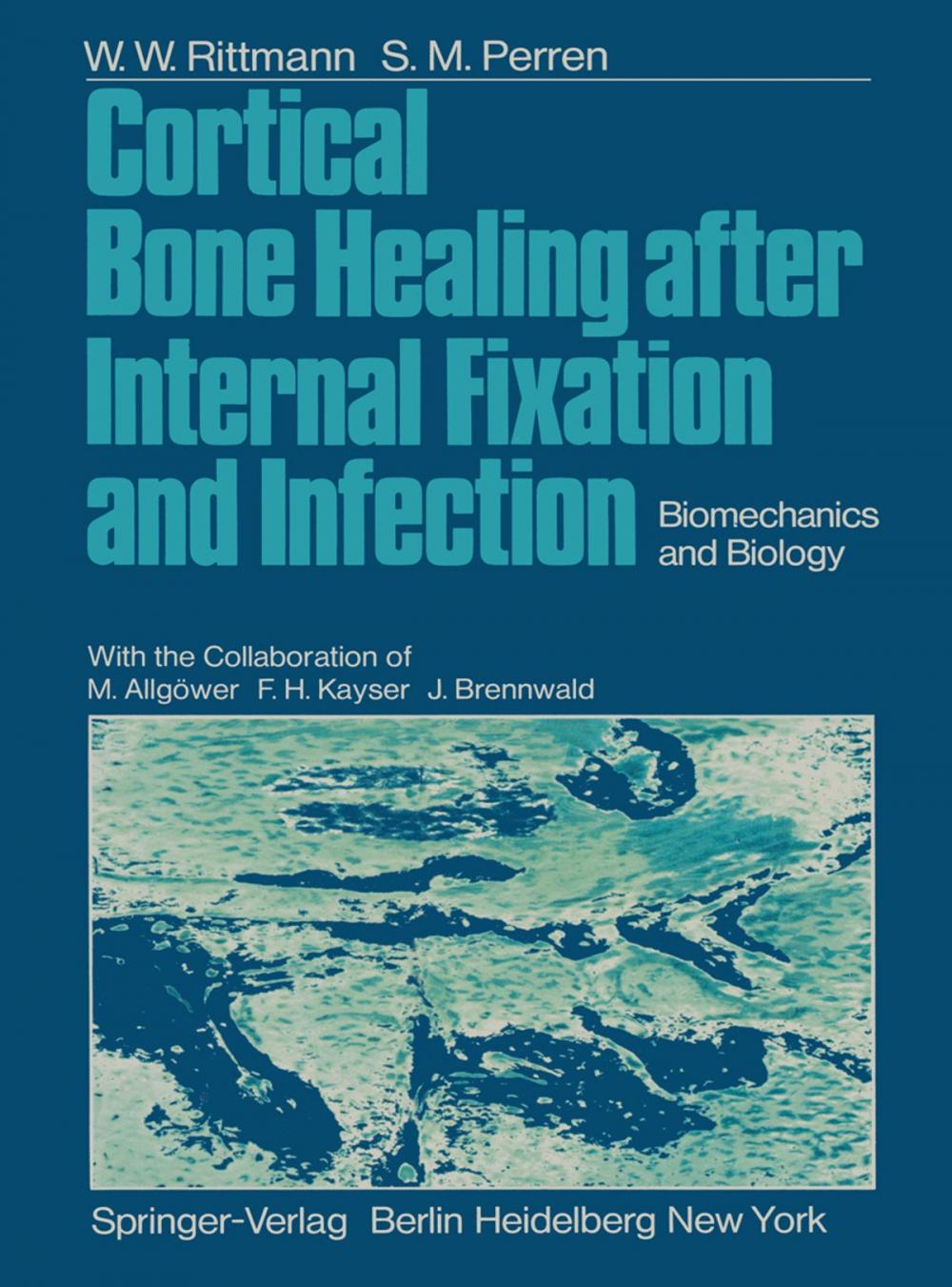 Big bigCover of Cortical Bone Healing after Internal Fixation and Infection