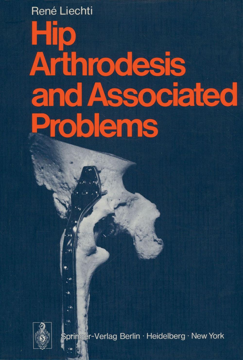 Big bigCover of Hip Arthrodesis and Associated Problems