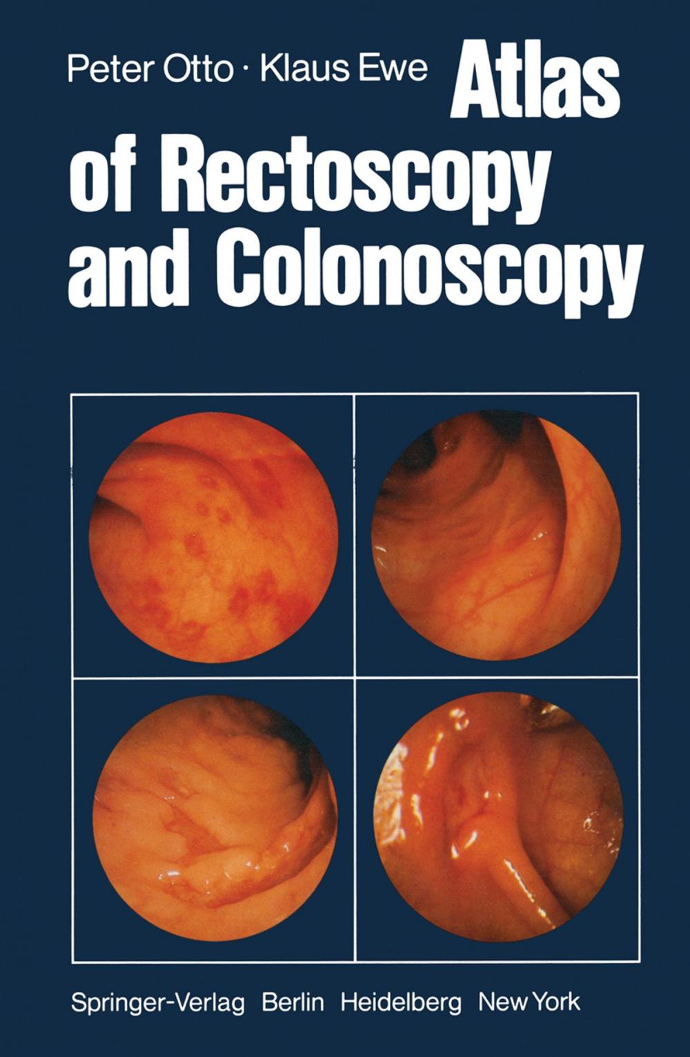 Big bigCover of Atlas of Rectoscopy and Coloscopy