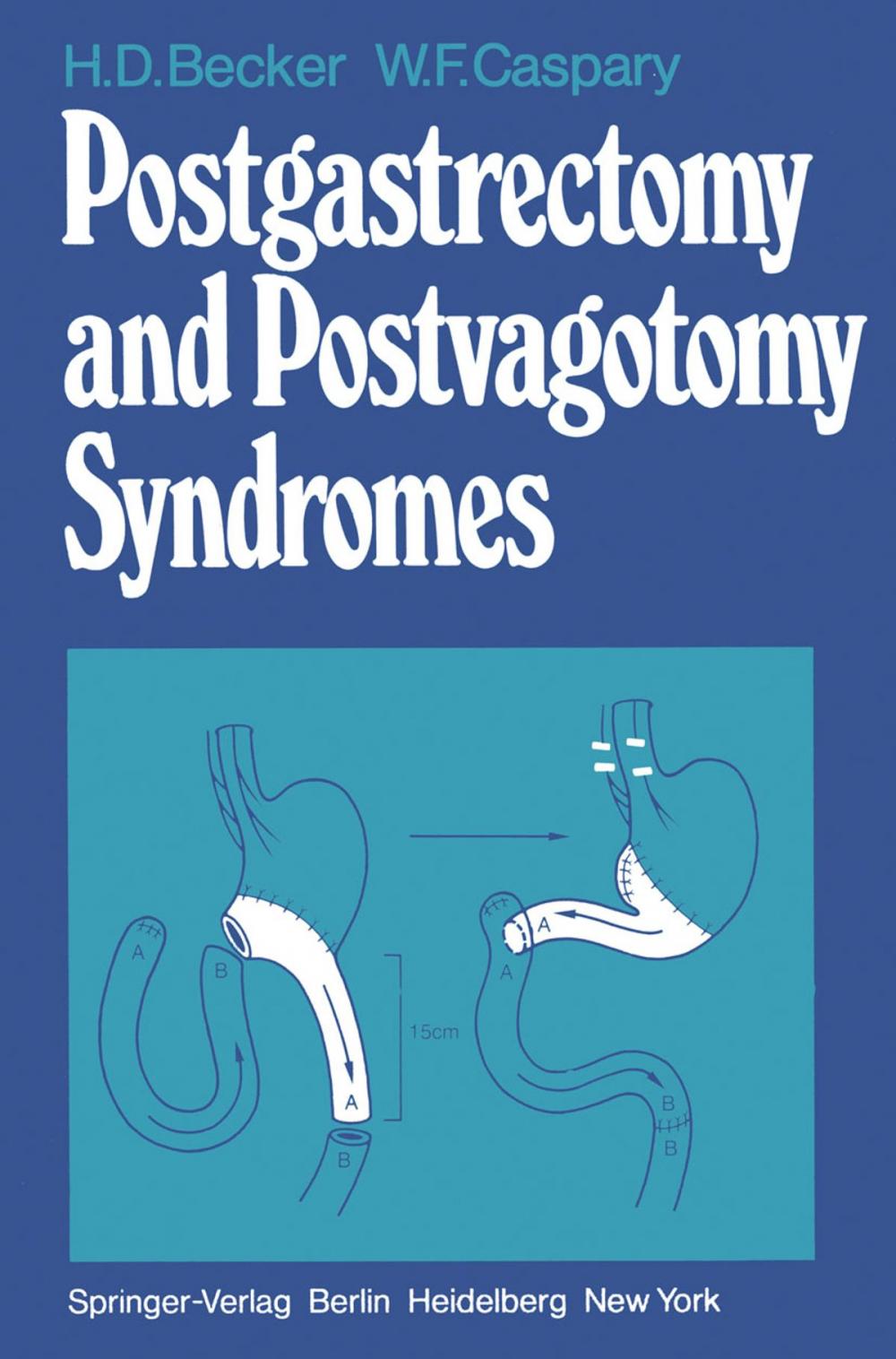 Big bigCover of Postgastrectomy and Postvagotomy Syndromes