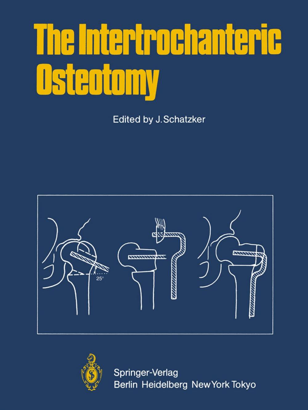 Big bigCover of The Intertrochanteric Osteotomy