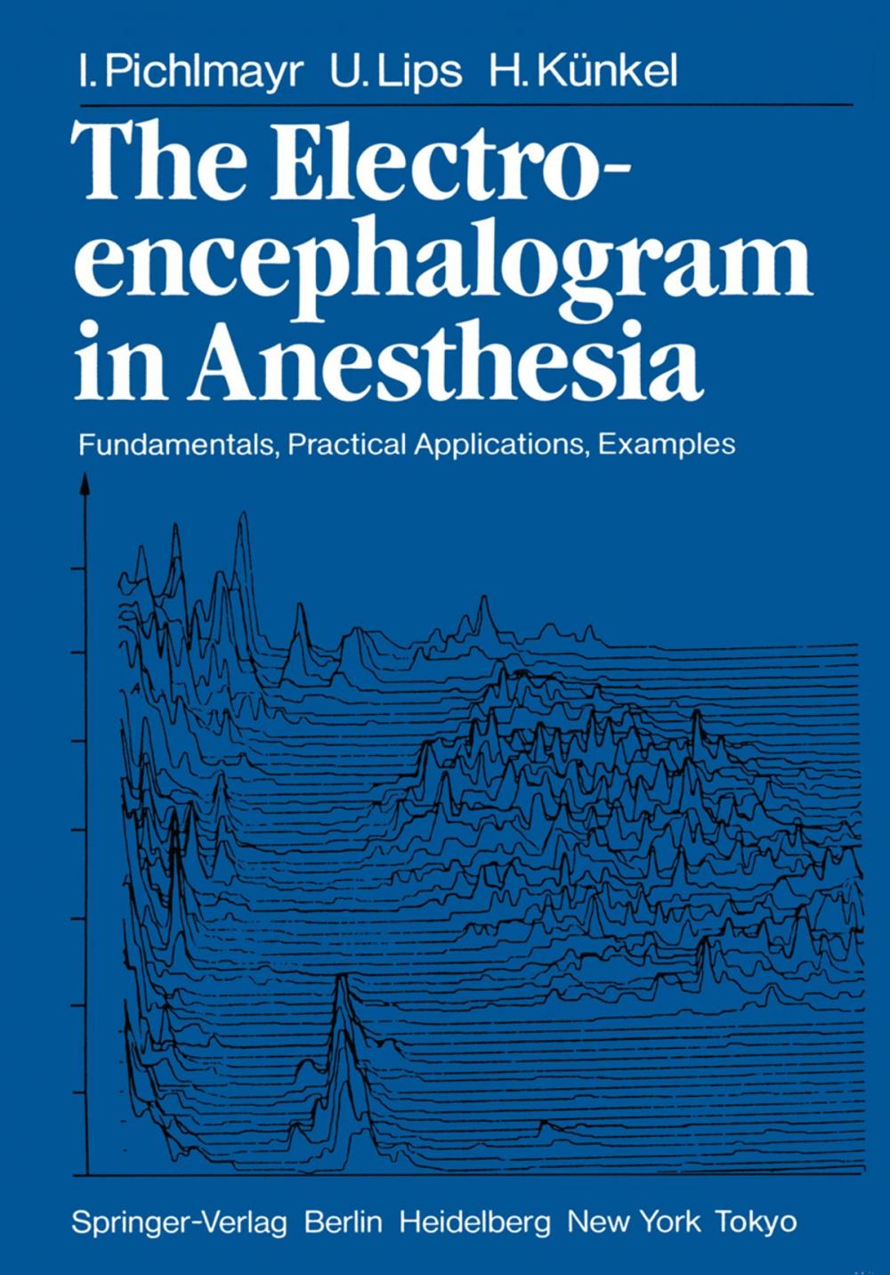 Big bigCover of The Electroencephalogram in Anesthesia