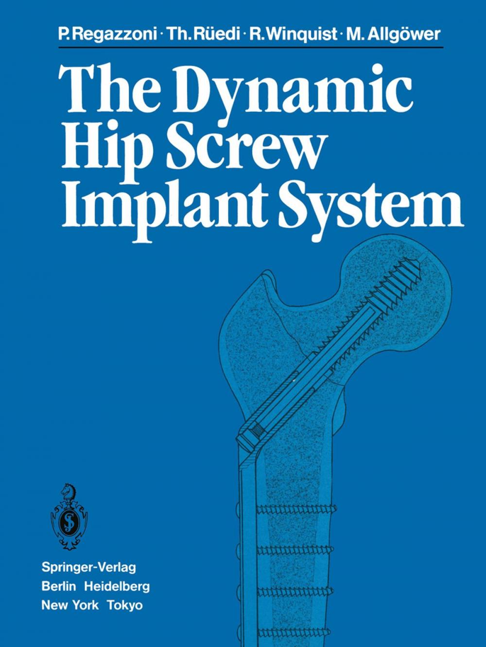 Big bigCover of The Dynamic Hip Screw Implant System