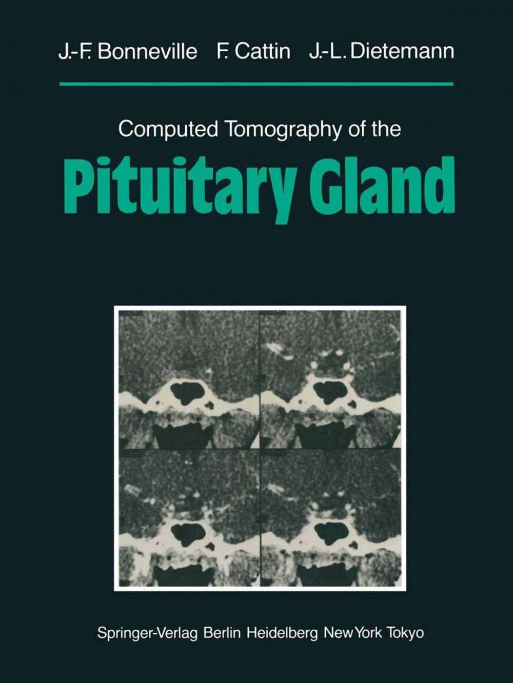 Big bigCover of Computed Tomography of the Pituitary Gland