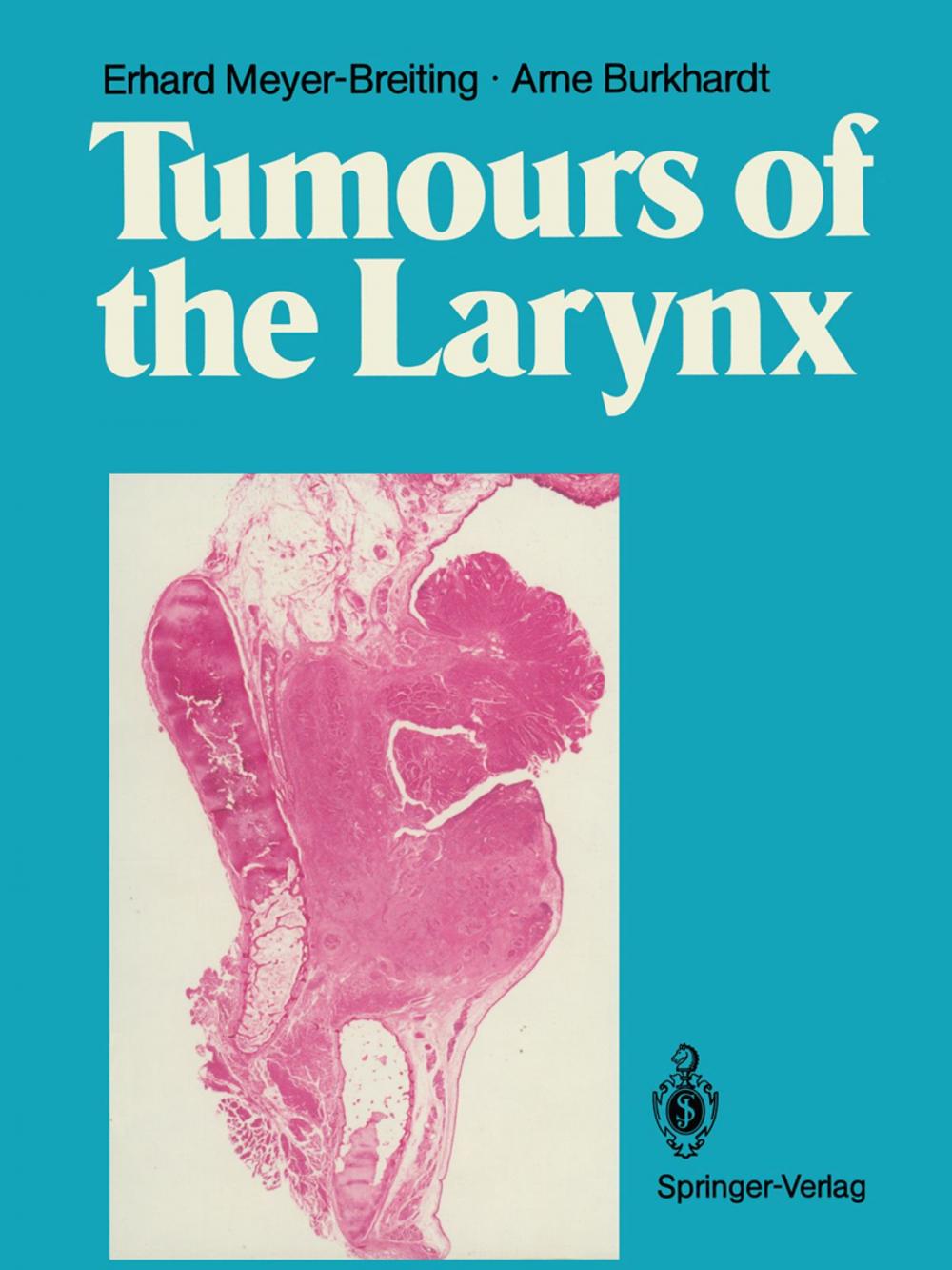 Big bigCover of Tumours of the Larynx