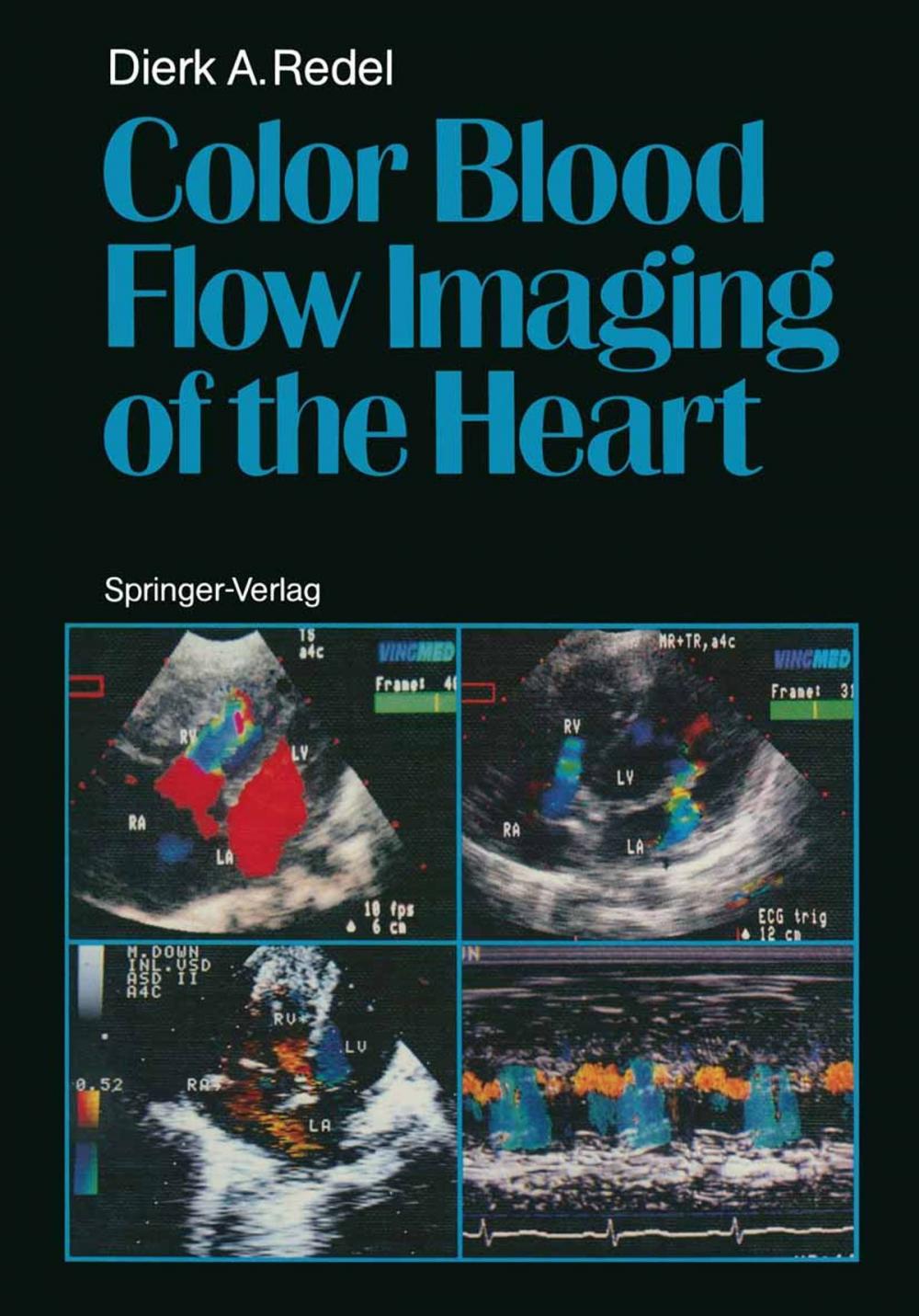 Big bigCover of Color Blood Flow Imaging of the Heart