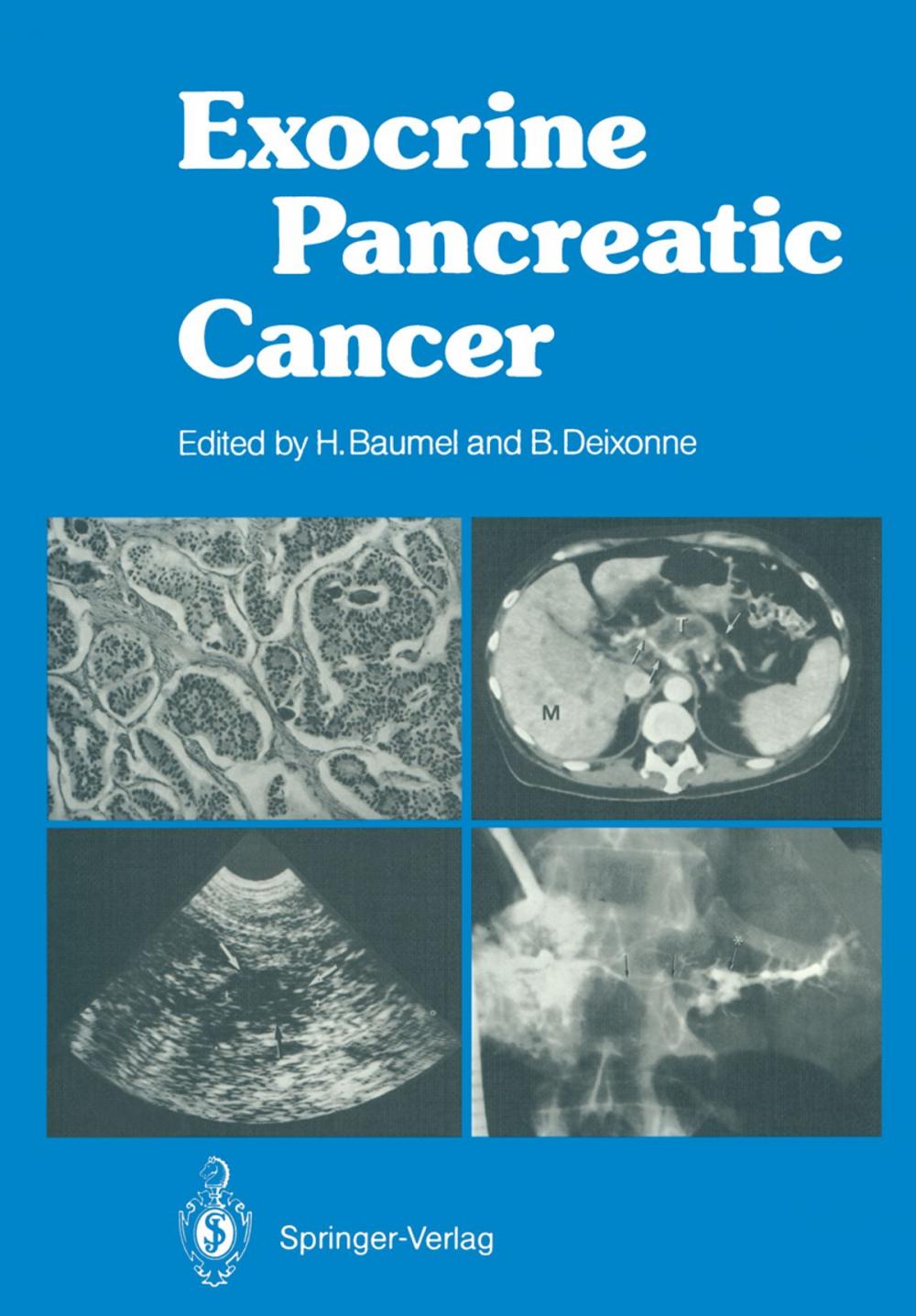 Big bigCover of Exocrine Pancreatic Cancer