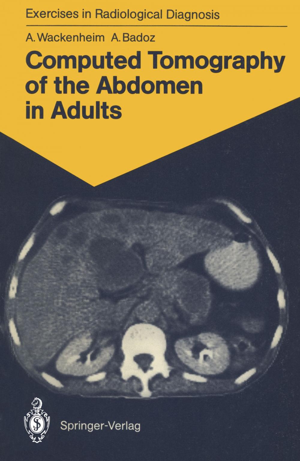 Big bigCover of Computed Tomography of the Abdomen in Adults